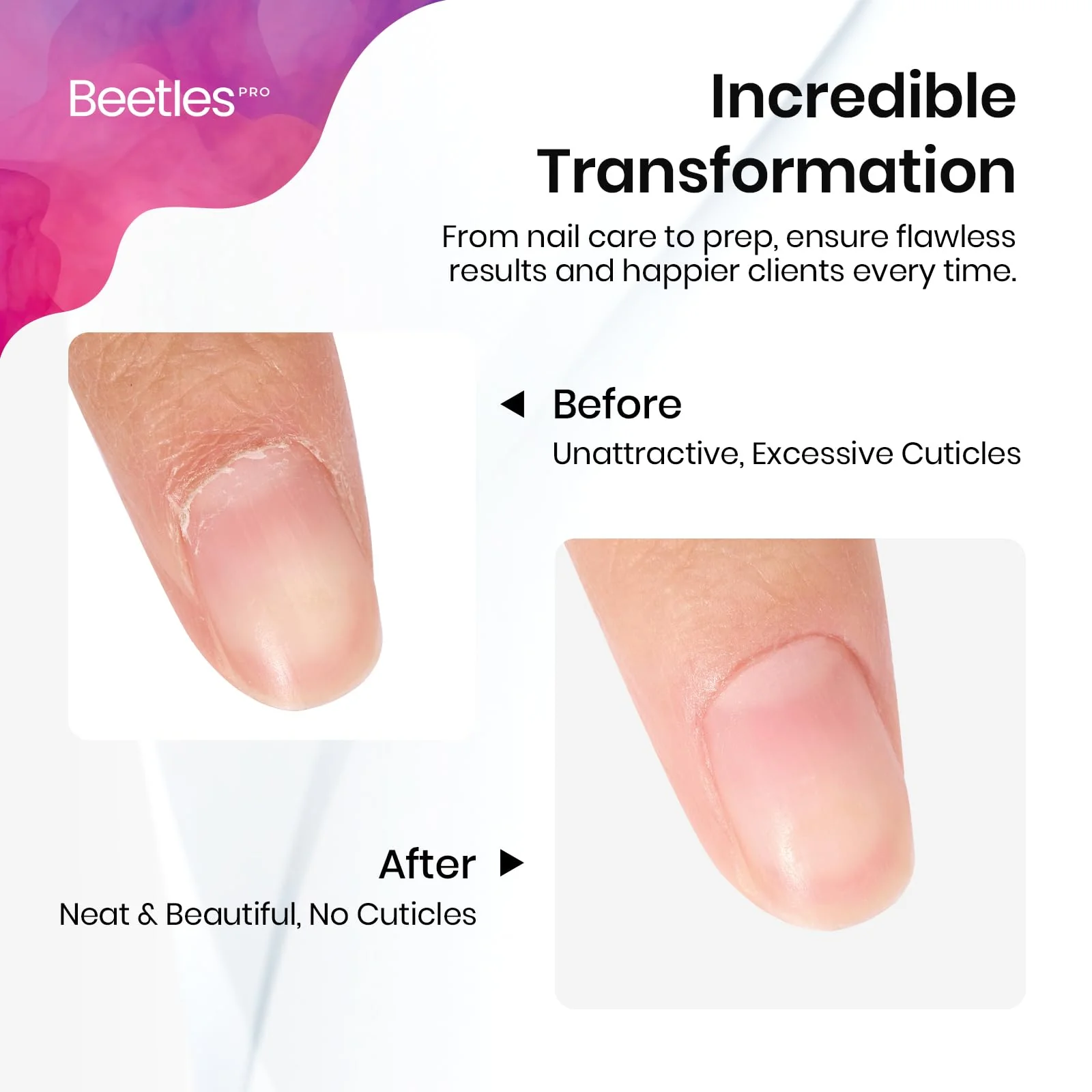 Beetles Dual-End Nail Pusher & Cuticle Cleaner 14mm Serrated Edge & 5mm Curved Blade - Image 6